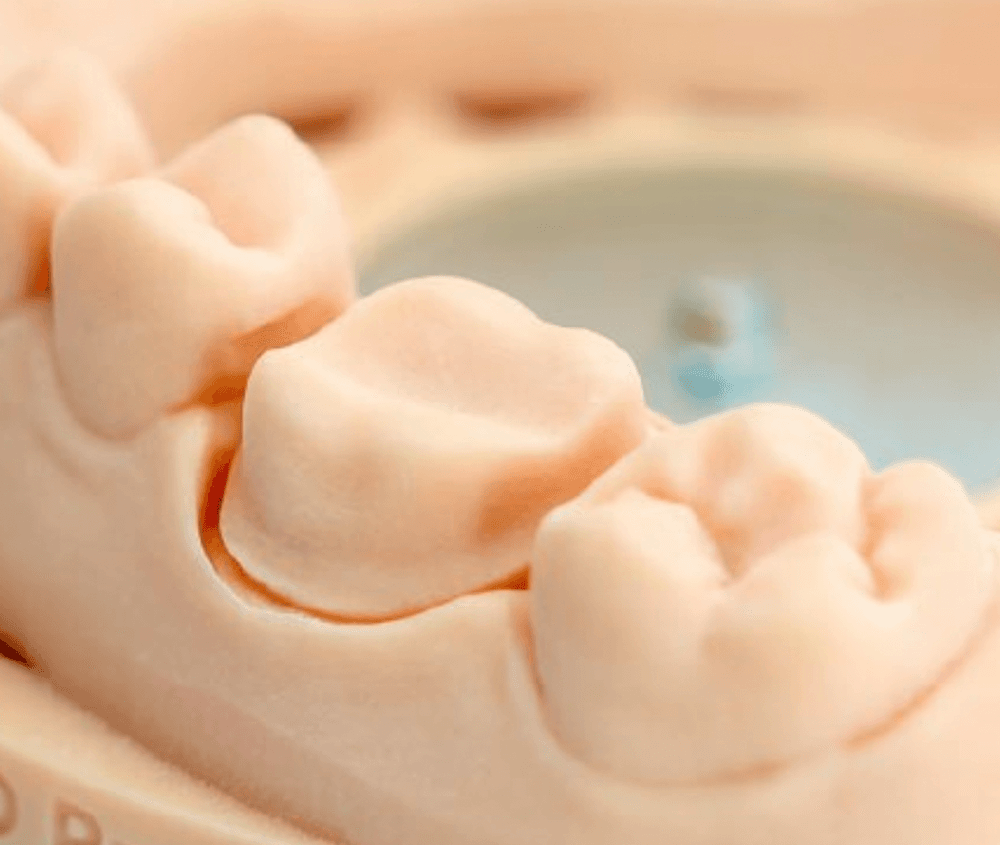 Gedrucktes Dentalmodell aus optiprint mattec caramel
