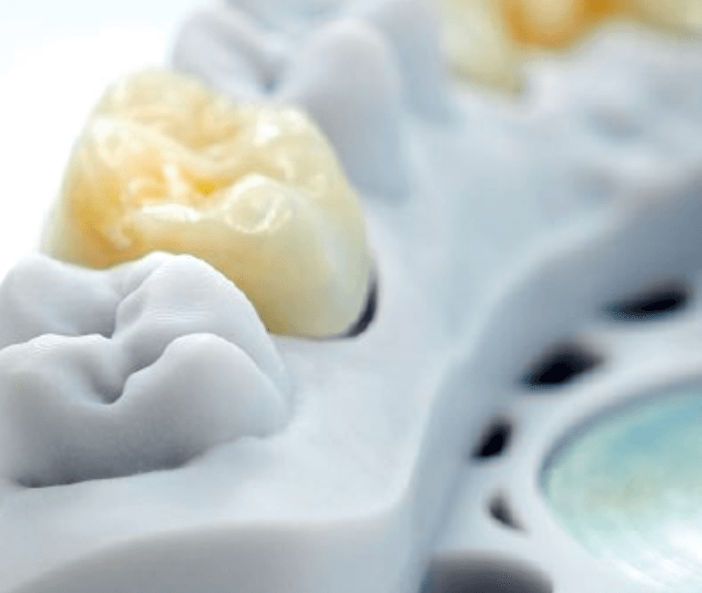 Gedrucktes Dentalmodell aus optiprint mattec delphin