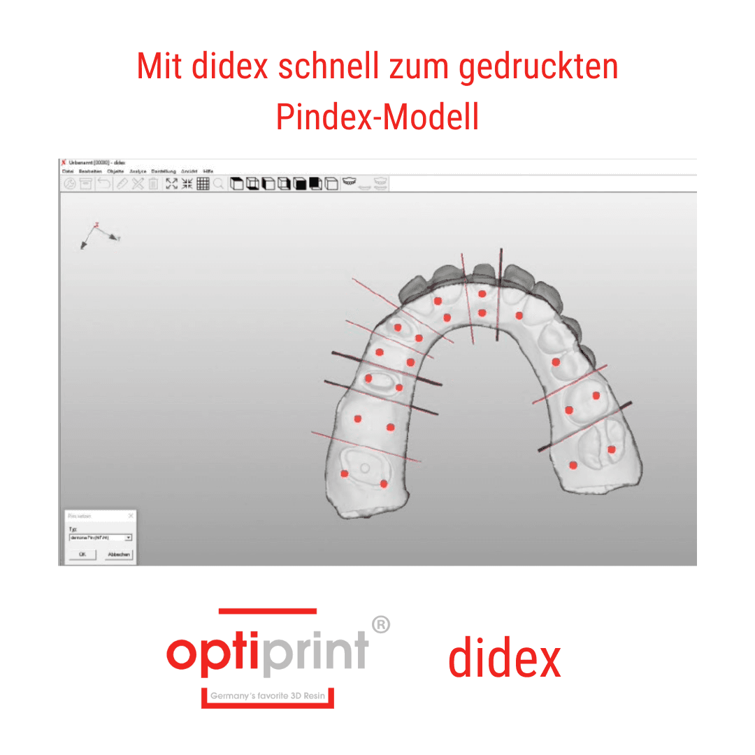 Digitales Unterkiefermodell mit markierten Sägeschnitten und Pinpositionen in CAD-Software
